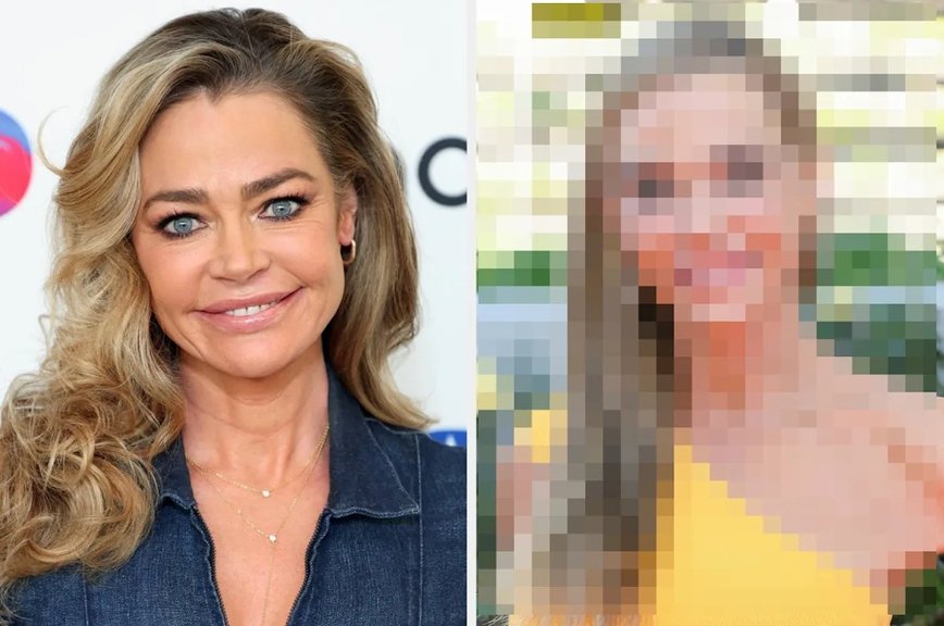 Denise Richards' Daring Facelift: A Transformation That's Turning Heads