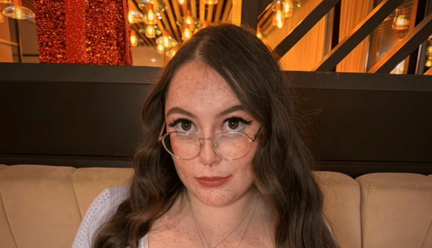 From Struggle to Stardom: How Summer Robert Turned Her Rare Condition into Fame