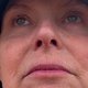 Tearful Tracy Shaw Faces Birthday Amid Cancer Battle