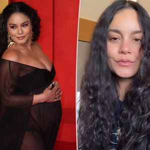 Vanessa Hudgens Opens Up About Her Postpartum Hair Loss with a Smile