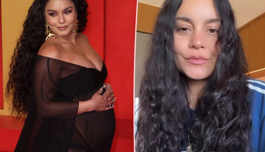 Vanessa Hudgens Opens Up About Her Postpartum Hair Loss with a Smile