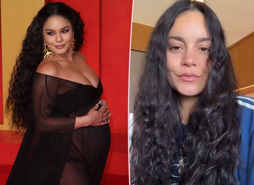 Vanessa Hudgens Opens Up About Her Postpartum Hair Loss with a Smile