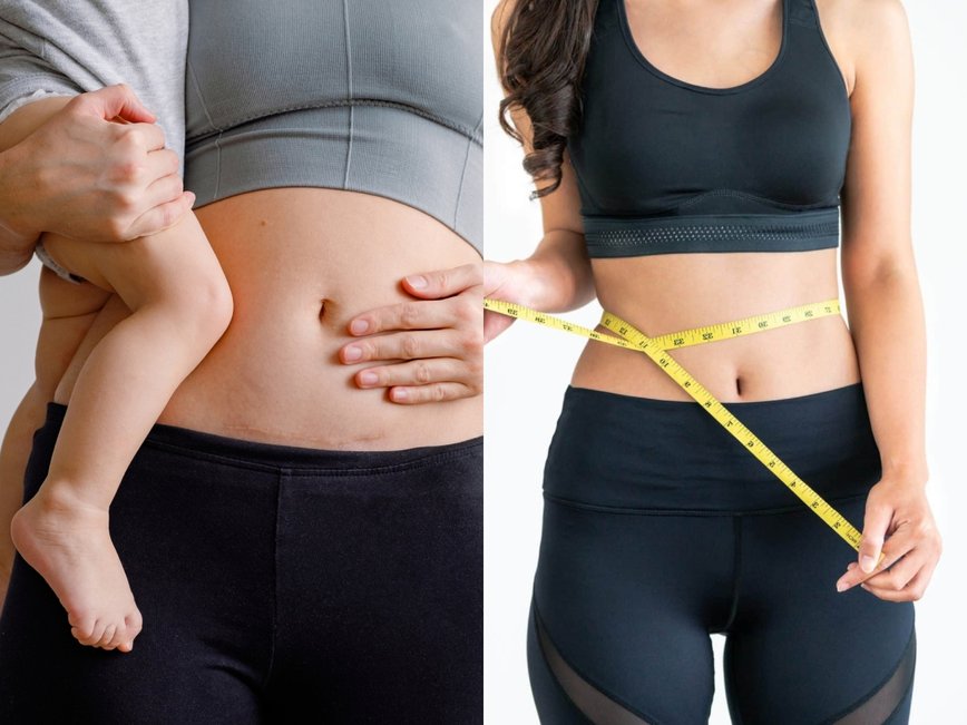 Celeb Moms' Post-Baby Glow-Up: Secrets to Shedding Pounds Fast in Hollywood and Worldwide