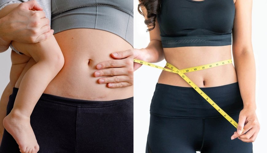 Celeb Moms' Post-Baby Glow-Up: Secrets to Shedding Pounds Fast in Hollywood and Worldwide